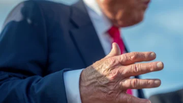 Trump padece insuficiencia venosa pero goza de buena salud, según la Casa Blanca