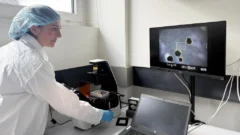 Los minicerebros humanos desarrollados por científicos para 
