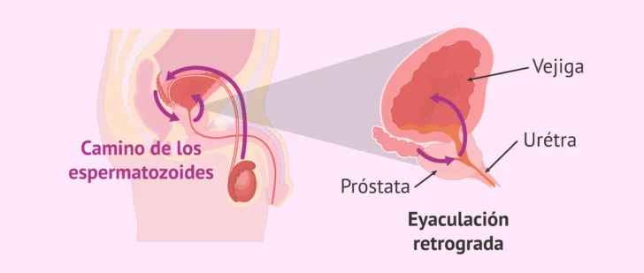 De la metáfora del “movimiento retrógrado” y otros objetos