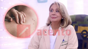 Dermatóloga advierte sobre el aumento silente del cáncer de piel en RD y la importancia de su detección temprana Dermatóloga advierte sobre el aumento silente del cáncer de piel en RD y la importancia de su detección temprana