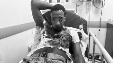 Presunto traficante de indocumentados hiere agente de Migración con arma de fuego casera