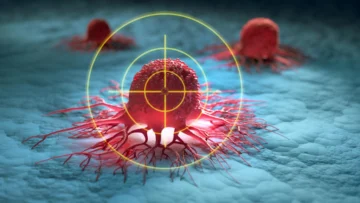 Cáncer: el 37,8 % de los nuevos casos podrían evitarse, según la OMS