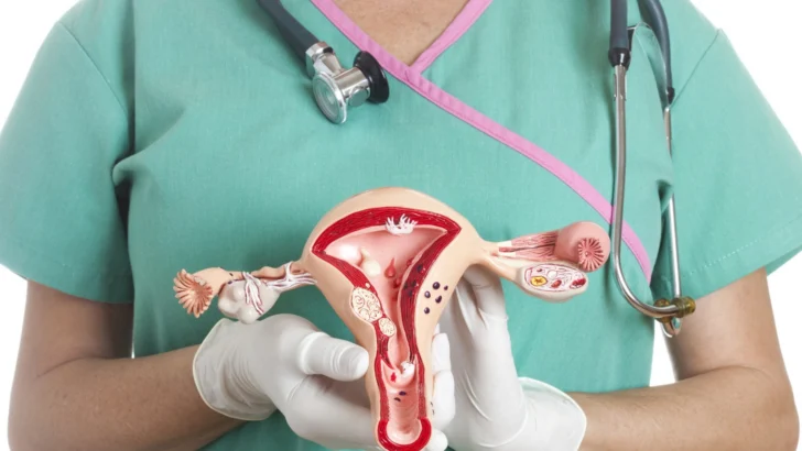 Especialistas llaman a prevenir el cáncer de cuello uterino asociado al HPV Especialistas llaman a prevenir el cáncer de cuello uterino asociado al HPV