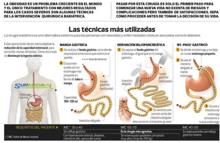 Esquema-de-lad-operaciones-728x475 Esquema-de-lad-operaciones-728x475