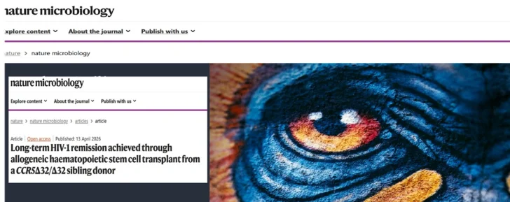 Paciente de VIH en remisión gracias a un excepcional golpe de suerte Paciente de VIH en remisión gracias a un excepcional golpe de suerte