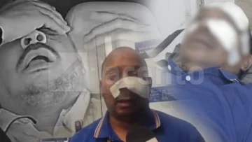 Chofer del TRAE agredido por motorista: “Creí que no iba a salir con vida”