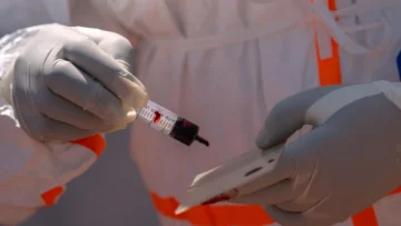 Francia detecta su primer caso de ébola en un médico que visitó la República Democrática del Congo