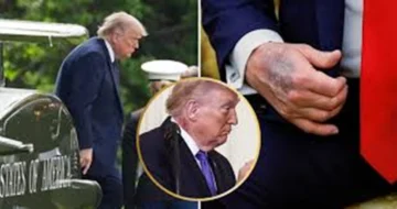 Médicos cuestionan el informe de salud de Trump, quién este mes cumplirá los 80 años