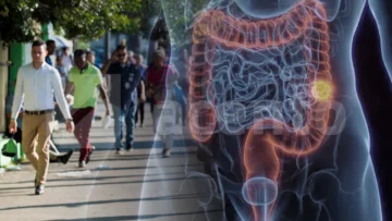 Cáncer colorrectal aumenta entre menores de 50 años: señales de alerta y medidas para reducir el riesgo