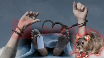 Fiscalía investiga muerte de hombre tras ser puesto en libertad; autopsia preliminar apunta a leptospirosis Fiscalía investiga muerte de hombre tras ser puesto en libertad; autopsia preliminar apunta a leptospirosis