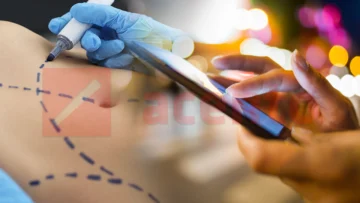 Encuesta de Acento: Mayoría considera que las redes sociales aumentan la presión para someterse a cirugías estéticas Encuesta de Acento: Mayoría considera que las redes sociales aumentan la presión para someterse a cirugías estéticas